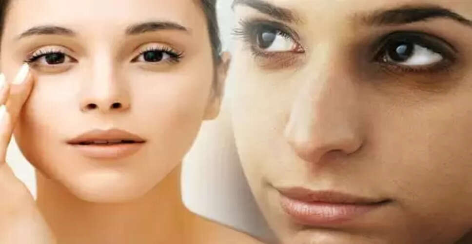 डार्क सर्कल्स से छुटकारा पाने के लिए दूध के उपयोग के उपाय