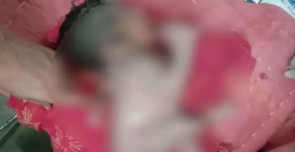 राजस्थान में जन्मा बच्चा, पीठ पर तीसरा हाथ: पॉलीमेलिया की अनोखी कहानी