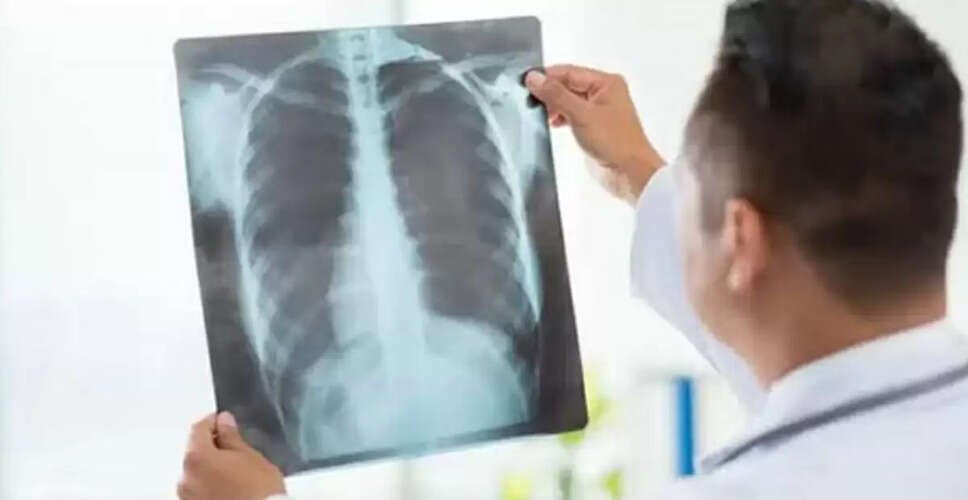 गूगल के नए AI मॉडल स्वास्थ्य सेवा में क्रांति लाने की क्षमता रखते हैं