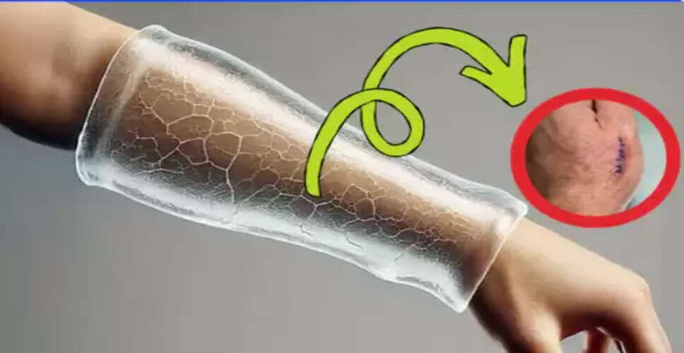 नवीनतम हाइड्रोजेल तकनीक: गंभीर घावों के उपचार में क्रांति