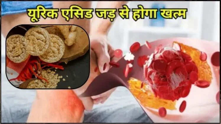 यूरिक एसिड को नियंत्रित करने के लिए अदरक और दलिया का उपयोग