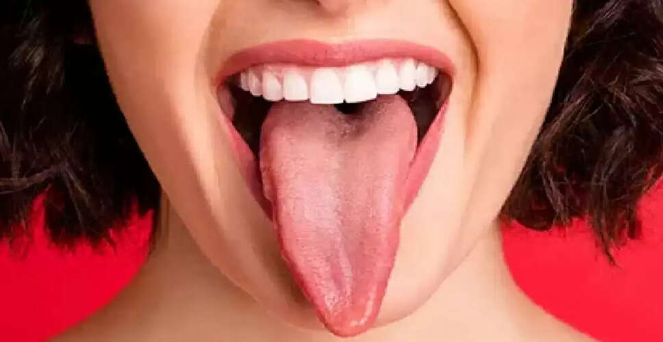 कोलेस्ट्रॉल के संकेत: जीभ के बदलावों से जानें स्वास्थ्य की स्थिति