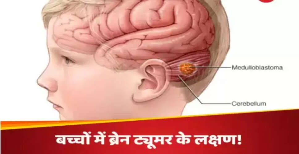 बच्चों में ब्रेन ट्यूमर के लक्षण: माता-पिता को ध्यान देने की जरूरत
