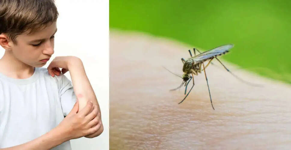 मच्छरों के काटने के पीछे का विज्ञान: जानें क्यों कुछ लोग बनते हैं लक्ष्य