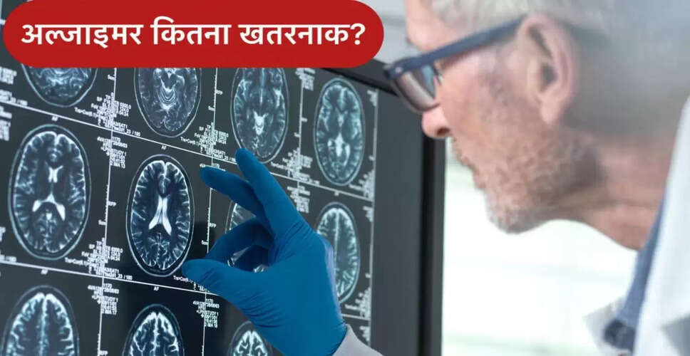 अल्जाइमर: एक गंभीर बीमारी और इसके लक्षण