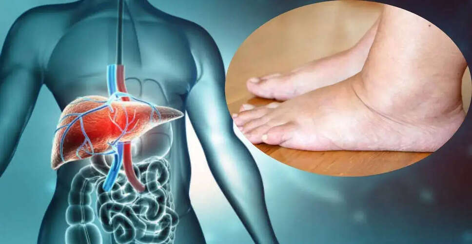 जिगर की सेहत के संकेत: पैरों के लक्षणों पर ध्यान दें