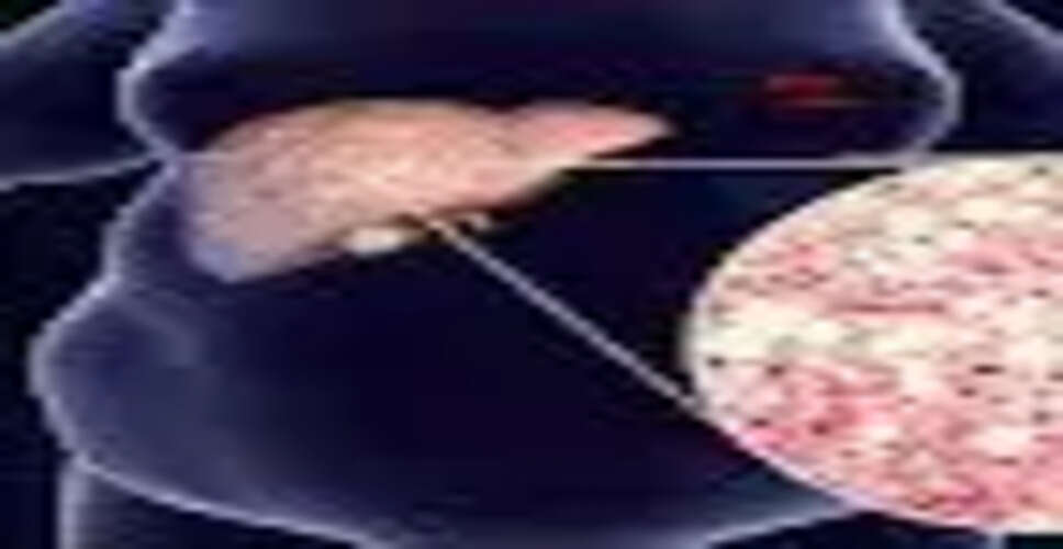 लिवर स्वास्थ्य पर मीठे का प्रभाव: जानें कैसे चीनी बनती है खतरा