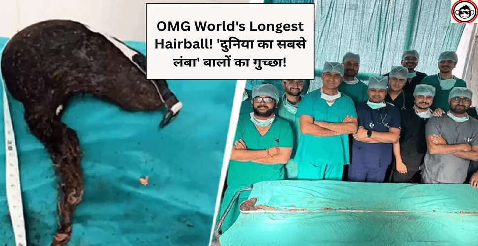 जयपुर में डॉक्टरों ने 14 वर्षीय बच्ची से निकाला 210 सेंटीमीटर लंबा हेयरबॉल