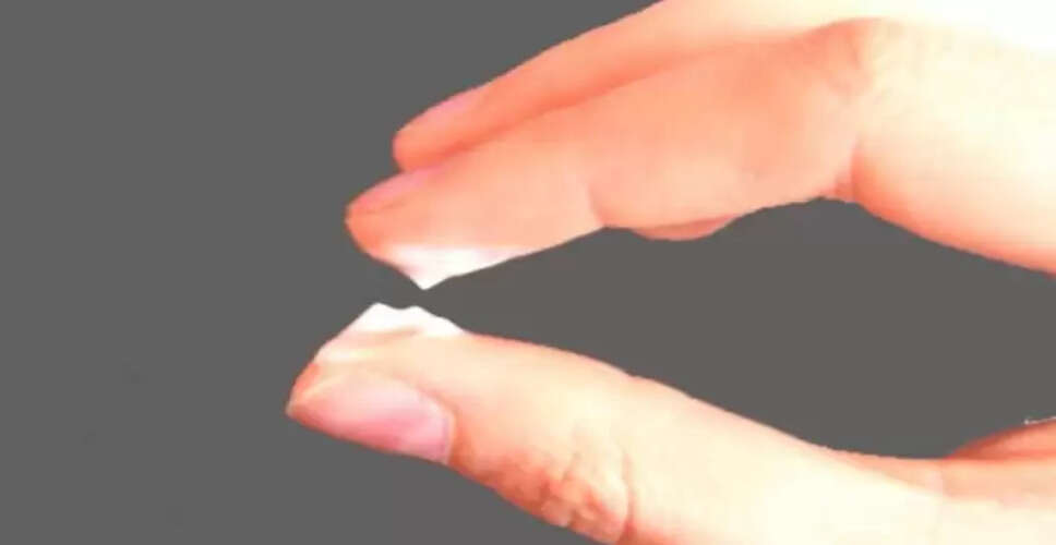 महिलाओं में व्हाइट डिस्चार्ज: कारण, लक्षण और घरेलू उपाय
