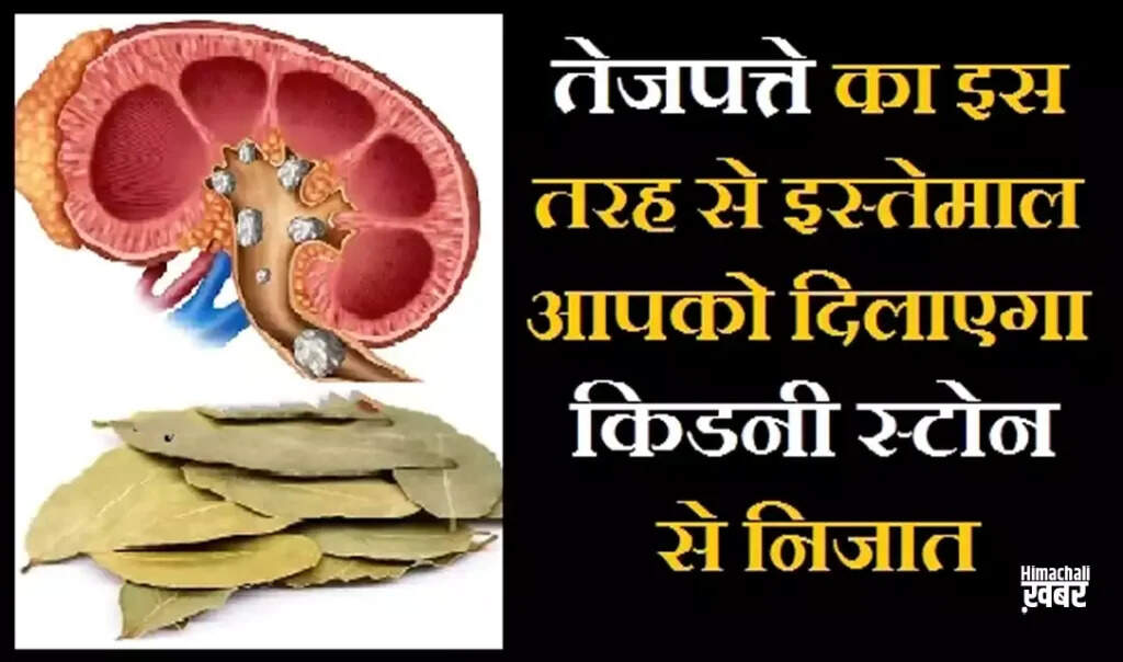 तेजपत्ते के अद्भुत स्वास्थ्य लाभ