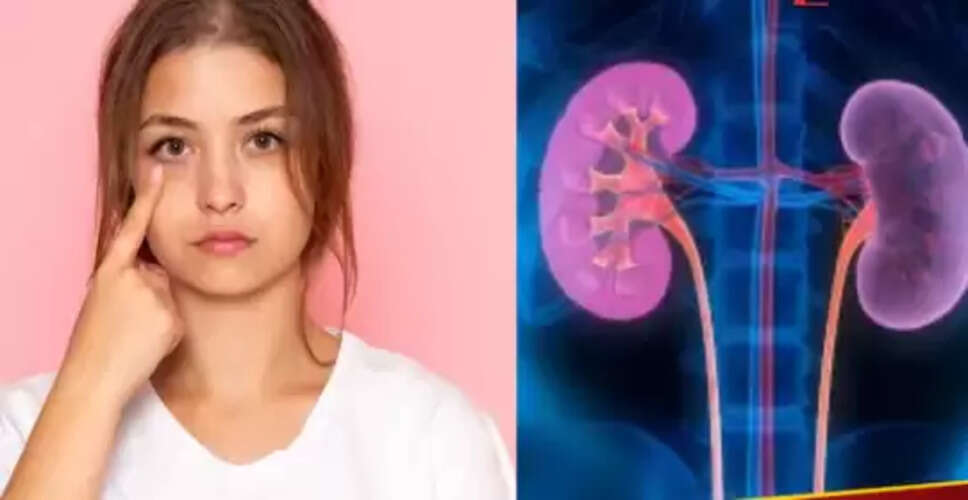 आंखों के संकेत: किडनी स्वास्थ्य के लिए सतर्कता जरूरी