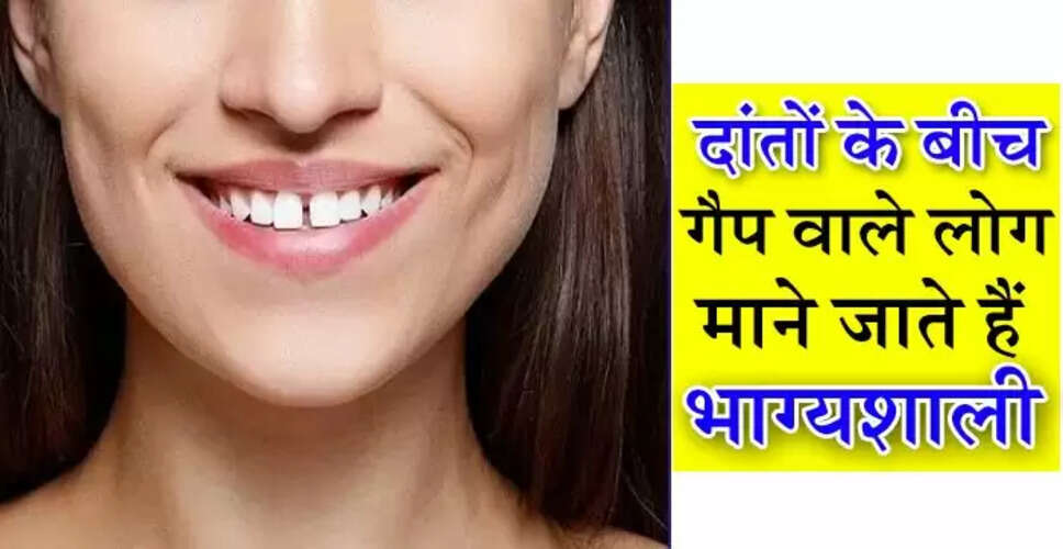 दांतों में गैप: जानें इसके पीछे छिपे रहस्य और विशेषताएं