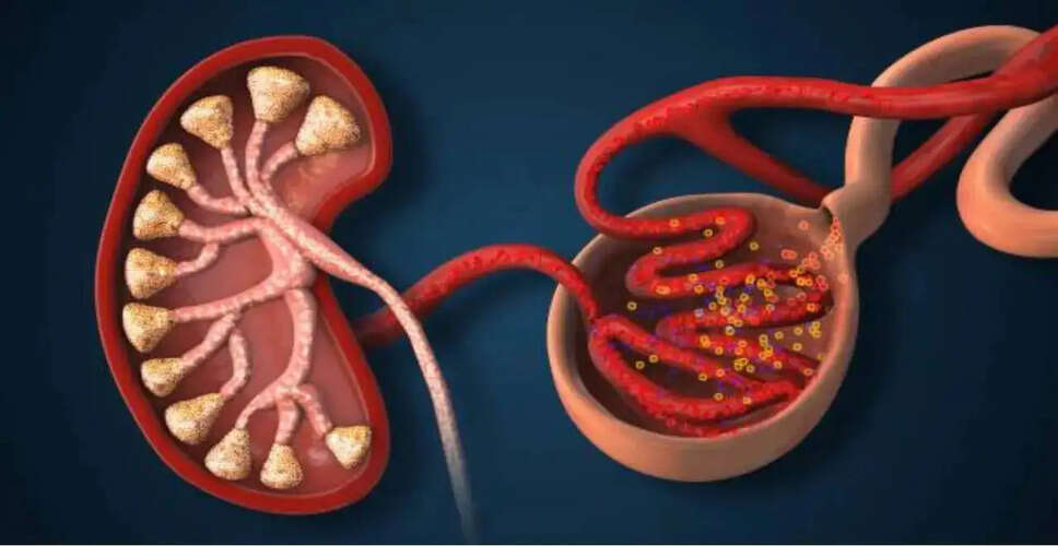ग्लोमेरुलोनेफ्राइटिस: गुर्दे की स्वास्थ्य समस्याओं के संकेत और उपचार