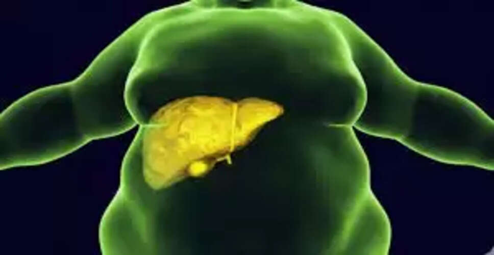 लिवर स्वास्थ्य के लिए हानिकारक खाद्य पदार्थों से बचें