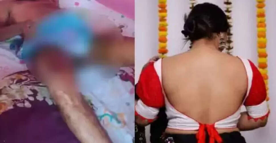 ग्वालियर में पत्नी ने पति पर खौलते तेल से किया हमला