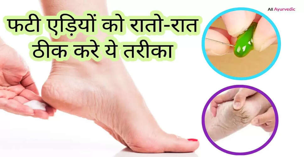 फटी एड़ियों के लिए प्रभावी घरेलू उपाय
