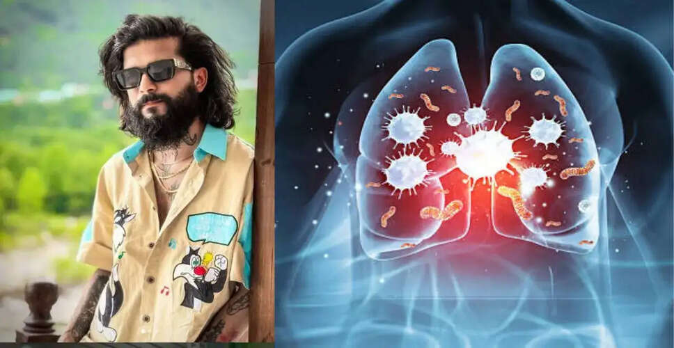 सोशल मीडिया इन्फ्लुएंसर अनुराग डोभाल को हुआ निमोनिया, स्वास्थ्य पर चिंता