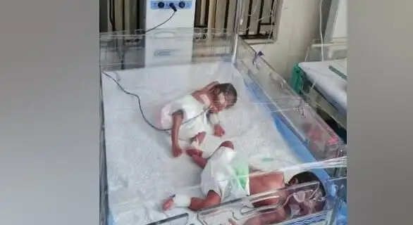 आगरा में एक महिला ने एक साथ चार बच्चों को जन्म दिया, कुल 7 बच्चों की मां बनीं