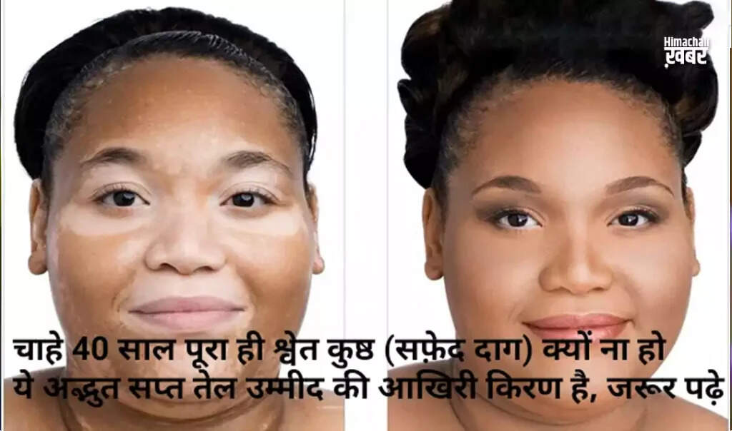 सप्त तेल का उपयोग: दादा मदन लाल जी का अनुभव