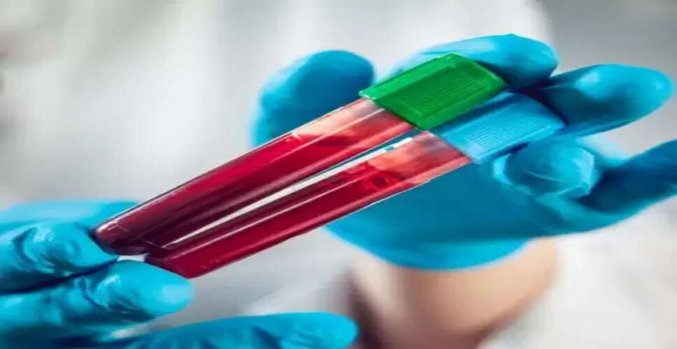 गर्भवती महिलाओं व बच्चों में सीसा विषाक्तता की होगी जांच