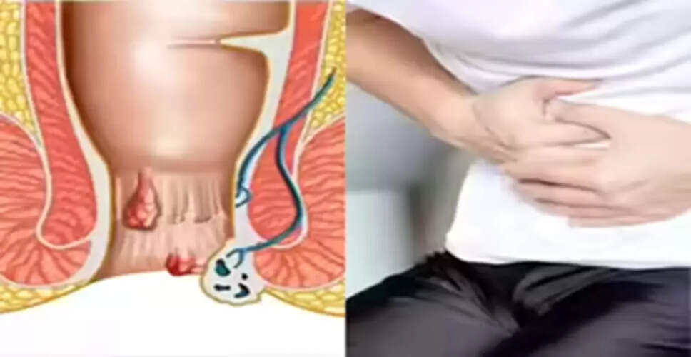 बवासीर के घरेलू उपचार: जानें कैसे पाएं राहत