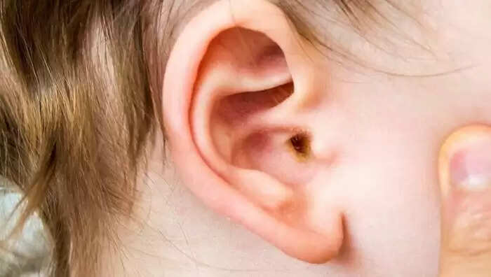 कान के बाल और जीवन के राज: जानें क्या कहते हैं ये संकेत