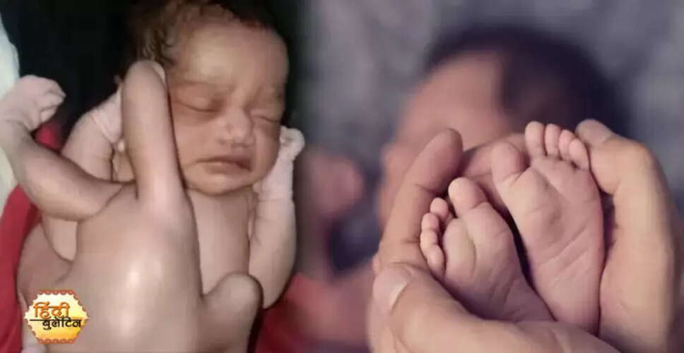 उत्तर प्रदेश में चार हाथ और चार पैर वाले बच्चे का जन्म