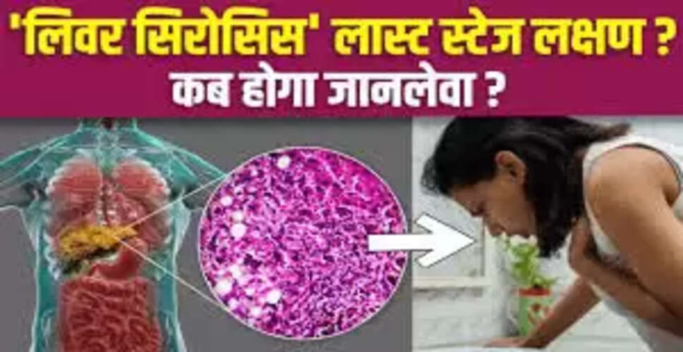 लिवर सिरोसिस: लक्षण, कारण और उपचार की जानकारी