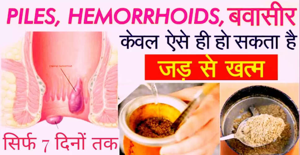 बवासीर: कारण, लक्षण और घरेलू उपचार