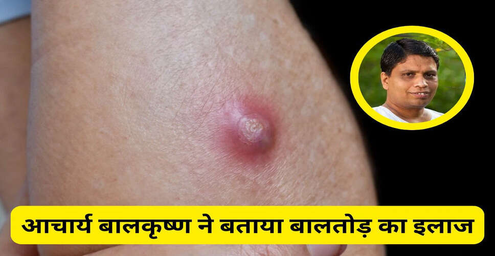 बालतोड़ के प्रभावी घरेलू उपचार: आचार्य बालकृष्ण की सलाह