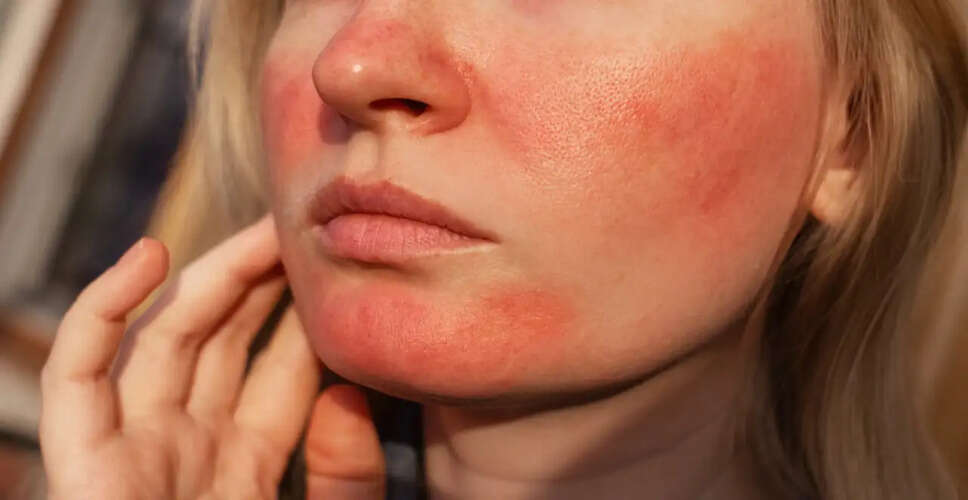 सूरज की जलन से राहत पाने के 8 सरल उपाय