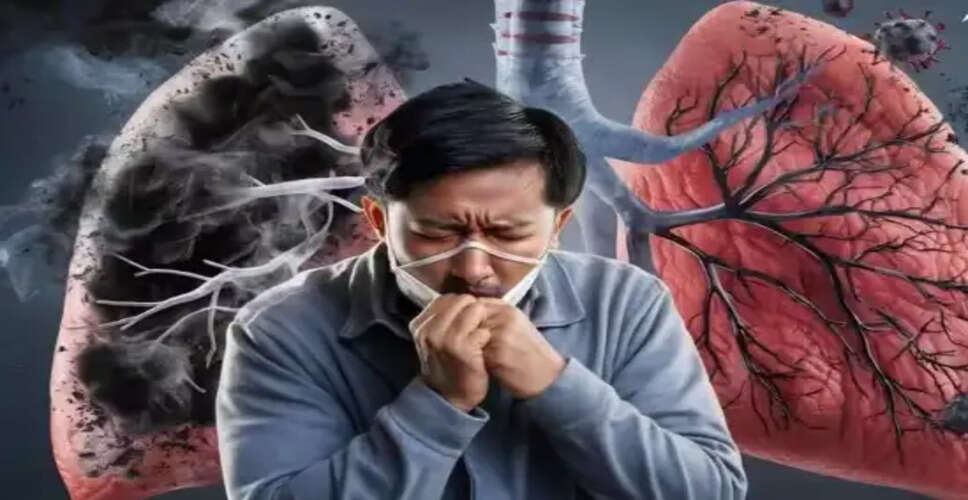 उत्तराखंड में टीबी का बढ़ता संकट: स्वास्थ्य विभाग की नई पहल