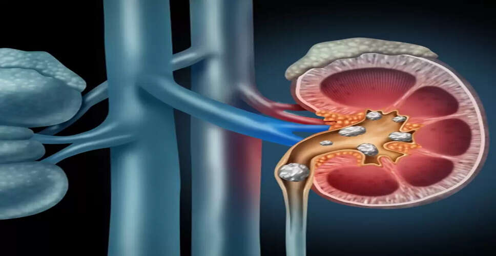 किडनी स्वास्थ्य के लिए फायदेमंद हर्बल चाय