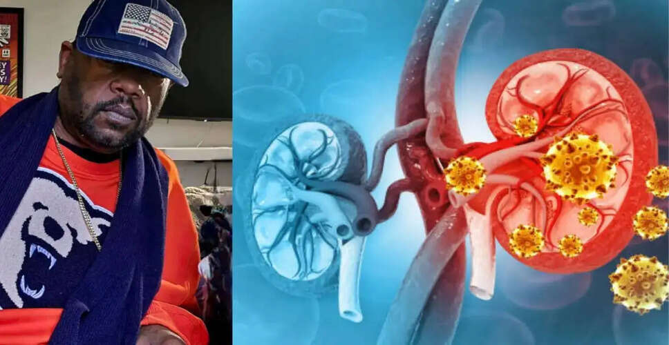 गंभीर किडनी रोग: ग्रिज़ चैपमैन की मृत्यु से मिली चेतावनी
