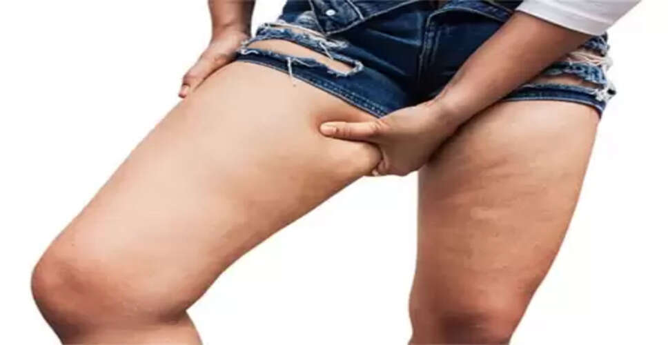 मोटी जांघों से हैं परेशान? ये योगासन करेंगे चर्बी घटाने में मदद
