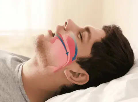 गर्मी में नींद की समस्या और हार्ट पर ऑब्सट्रक्टिव स्लीप एपनिया का प्रभाव