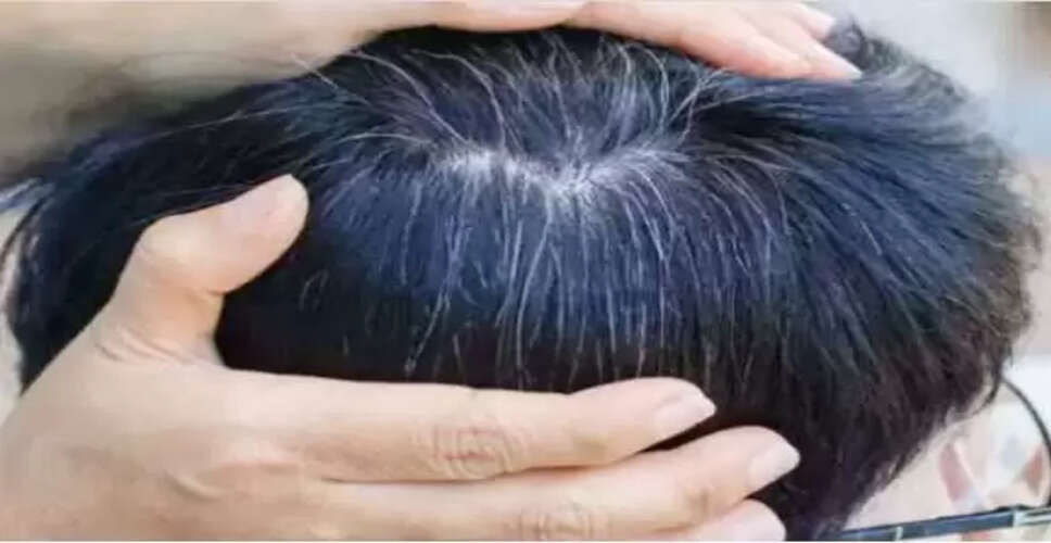 कम उम्र में सफेद बालों की समस्या: विटामिन बी का महत्व