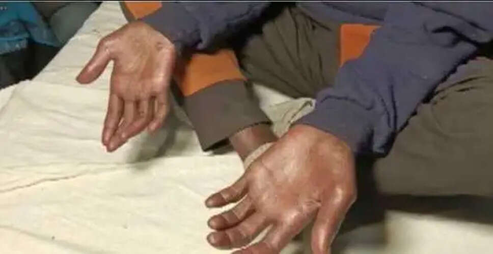 शाहजहांपुर में रहस्यमयी बीमारी से प्रभावित परिवार के 8 सदस्य