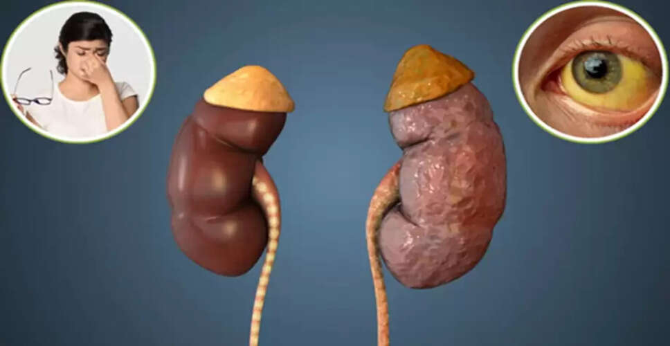 गुर्दे की विफलता के लक्षण: आंखों की समस्याएं और अन्य संकेत