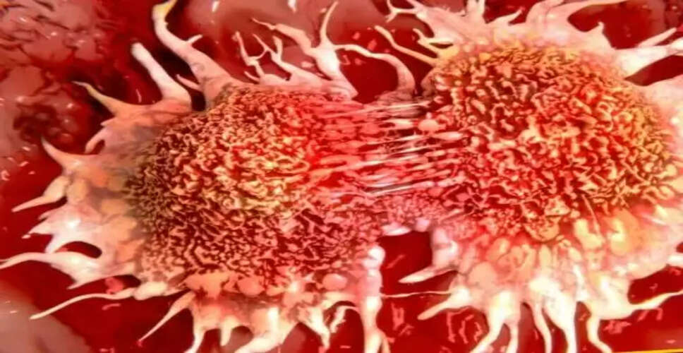 हार्वर्ड के डॉक्टरों की चेतावनी: रोजाना खाने वाली 6 चीजें कैंसर का खतरा बढ़ा सकती हैं