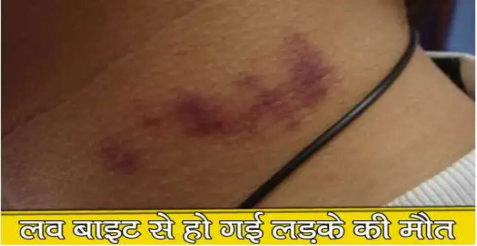 लव बाइट के खतरनाक परिणाम: जानिए एक चौंकाने वाली घटना