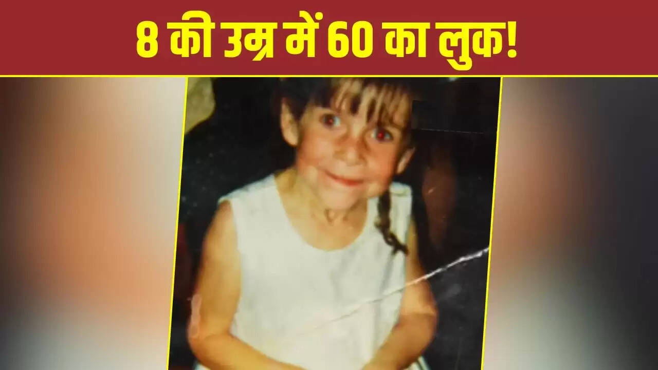 बूढ़ी दिखने वाली बच्ची की अनोखी कहानी: जारा हार्टशोर्न की जिंदगानी