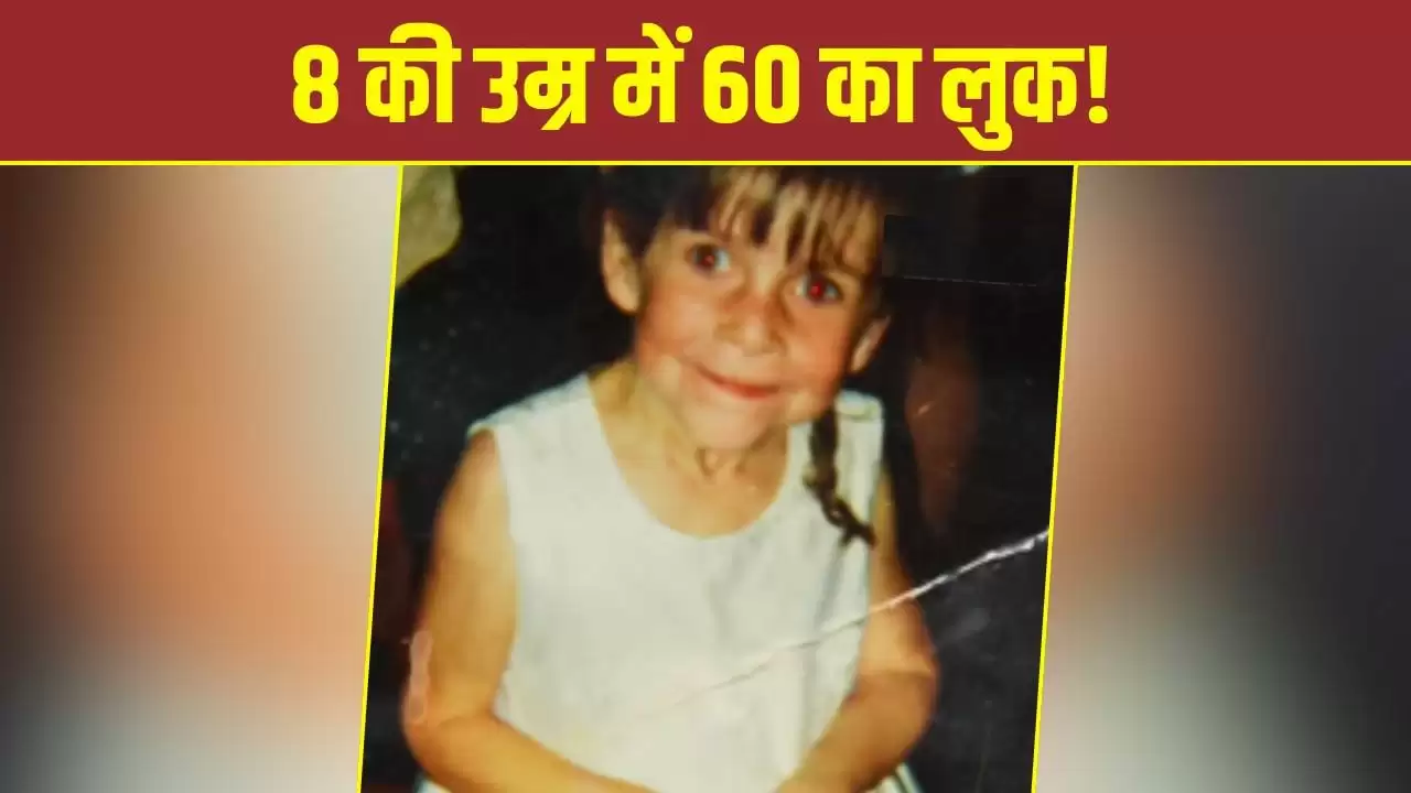 बूढ़ी दिखने वाली बच्ची की अनोखी कहानी: जारा हार्टशोर्न की जिंदगानी