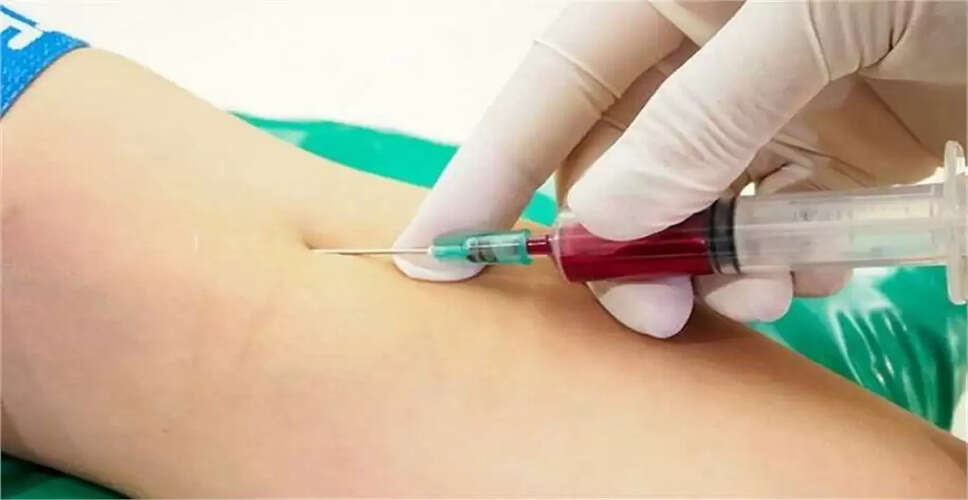 Quick Vitals ऐप: बिना खून के स्वास्थ्य जांच का नया तरीका