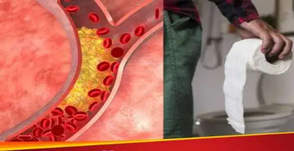 इसबगोल: कोलेस्ट्रॉल कम करने का प्राकृतिक उपाय