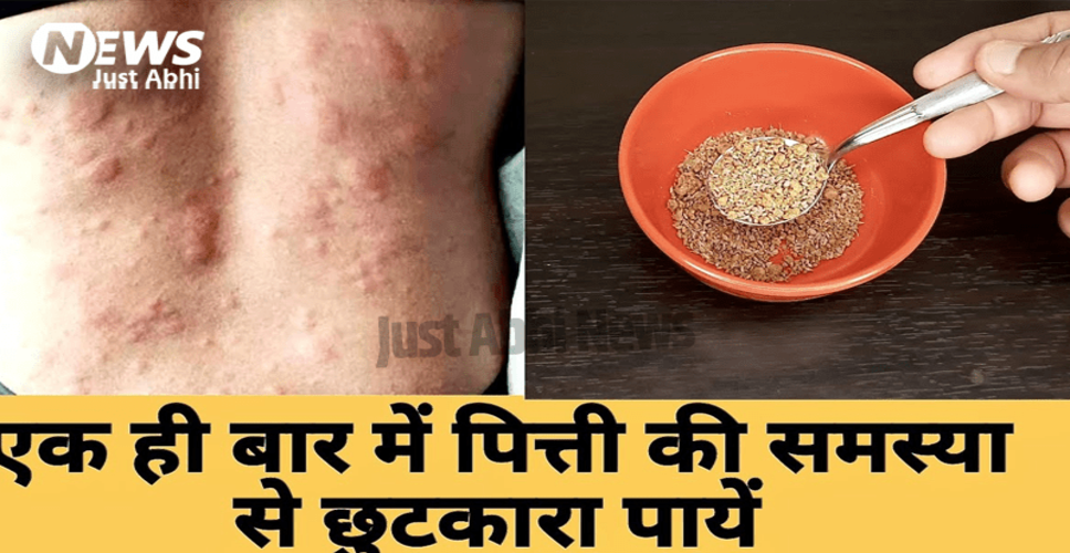 पित्ती: कारण, लक्षण और उपचार के उपाय
