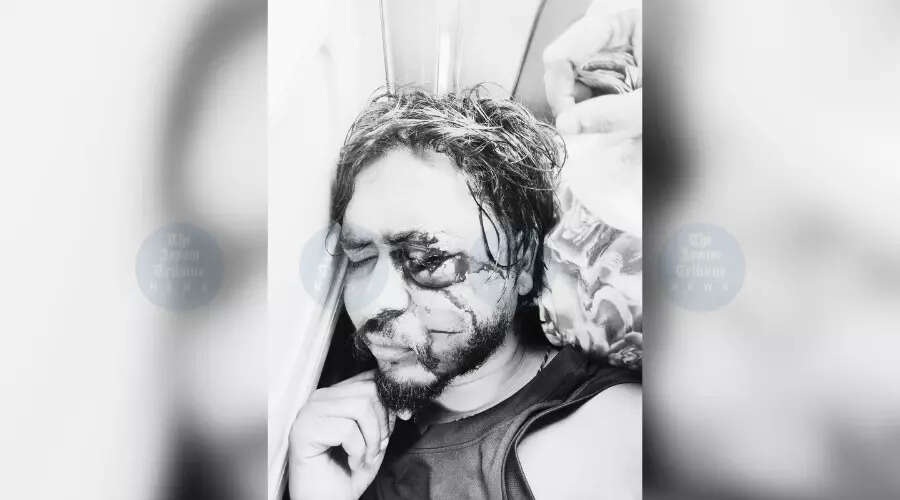 डिब्रूगढ़ में मवेशी चोरी के विवाद में हिंसा, एक युवक घायल