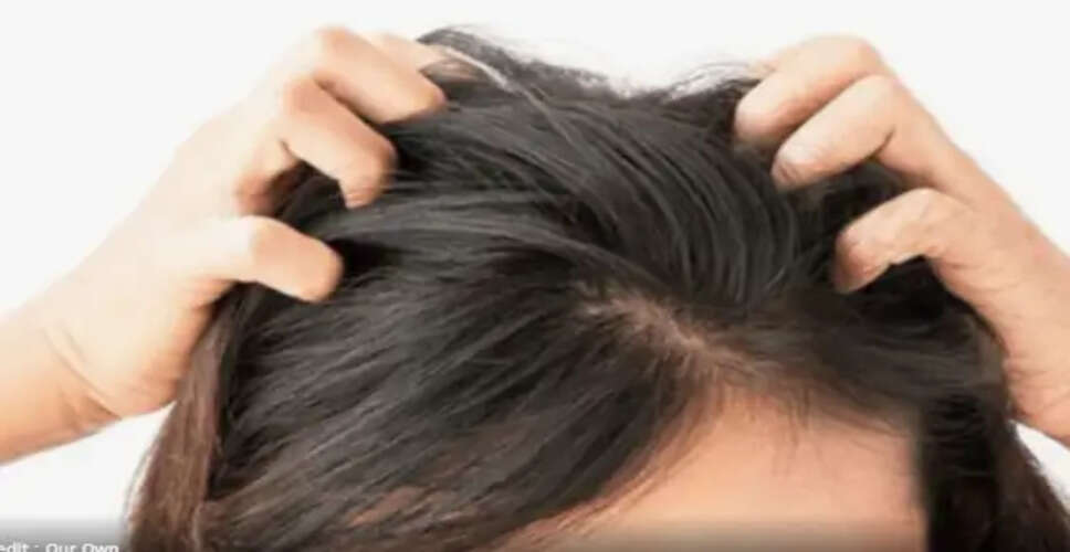 लक्ष्मीप्रिया की जूं की समस्या: एक गंभीर स्वास्थ्य संकट