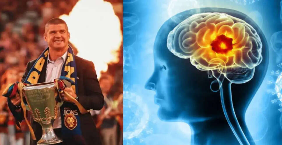 जॉनाथन ब्राउन ने ब्रेन ट्यूमर सर्जरी के बाद साझा किया अनुभव