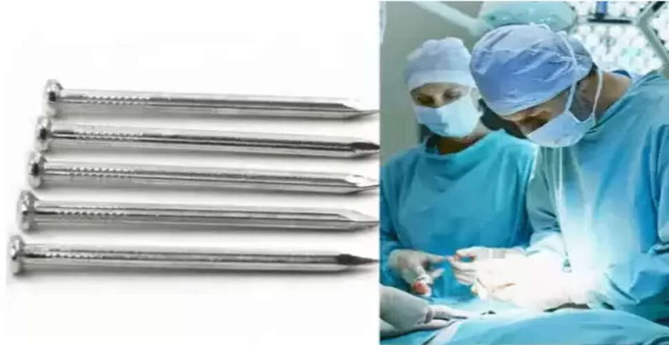 यूपी में युवक ने सिर में ठोंकी कील, डॉक्टरों ने बचाई जान